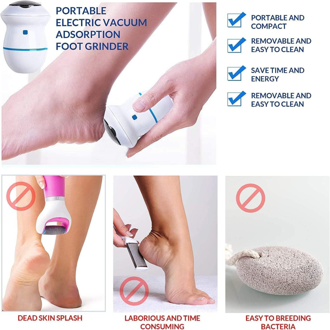Foot Grinder Electric Callus Remover