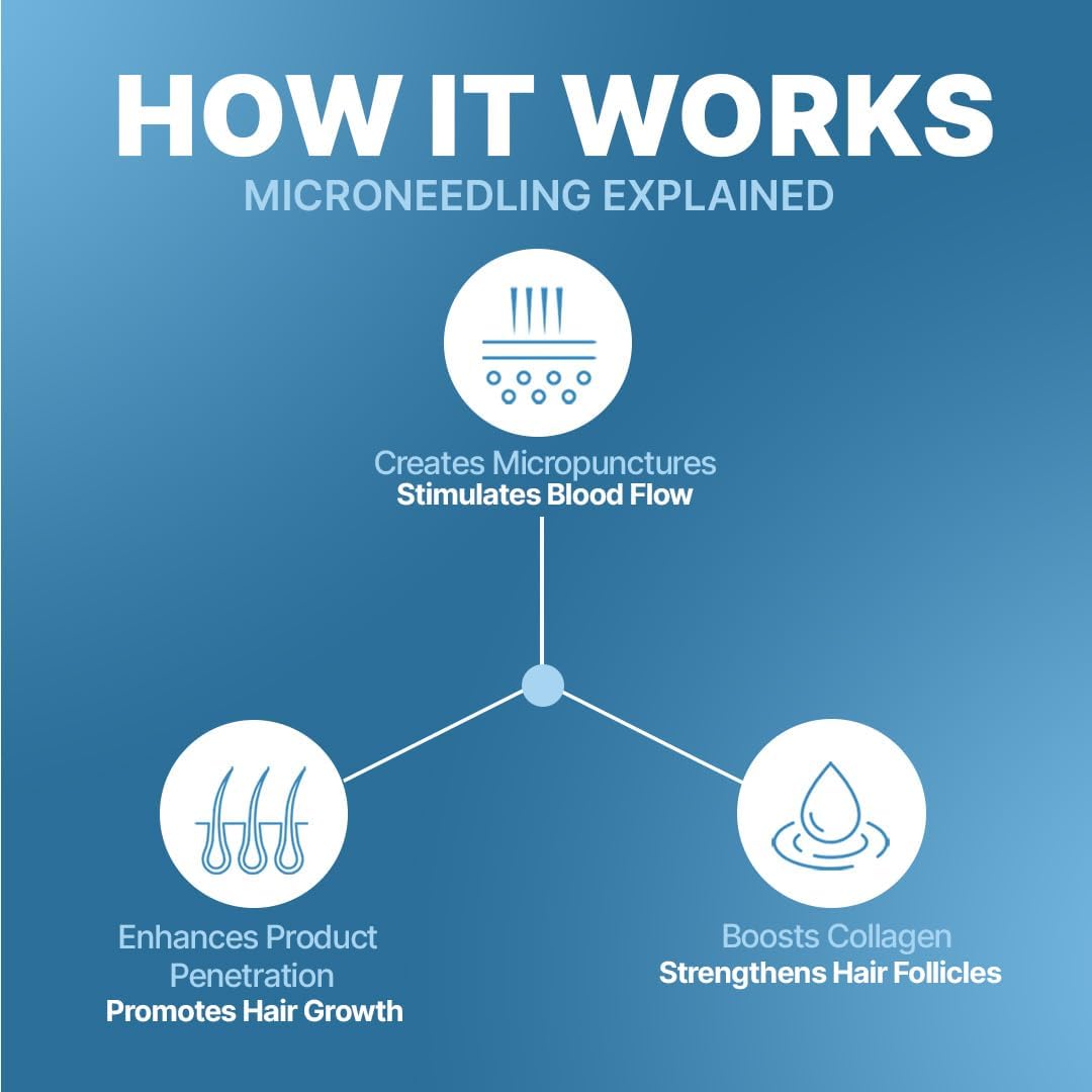 Derma Roller For Hair Growth 1 mm with 540 Stainless Steel Needles