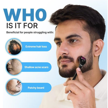 Derma Roller For Hair Growth 1 mm with 540 Stainless Steel Needles