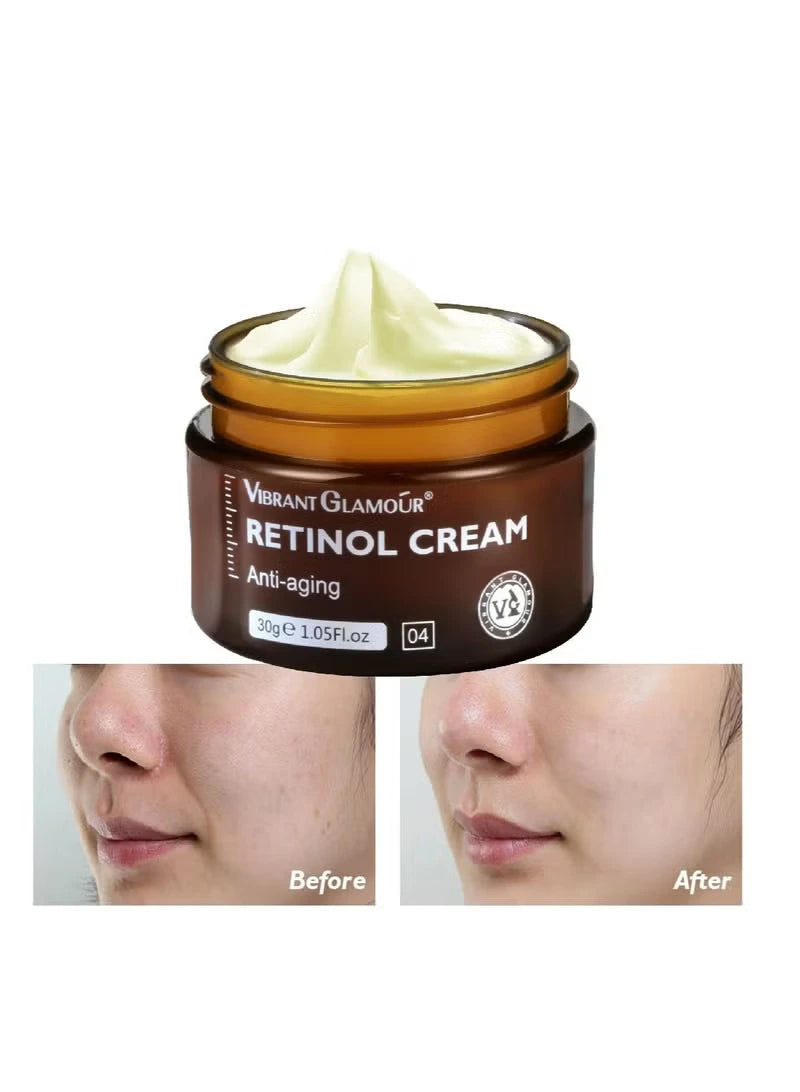 Retinol Cream – Anti-Aging Face Moisturizer for Wrinkles & Firming, 30g