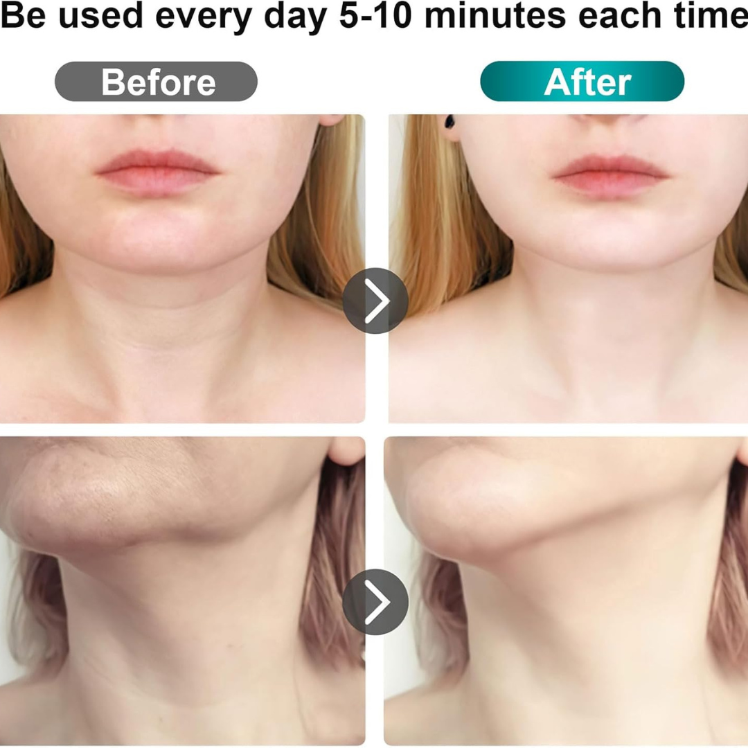 Advanced EMS Face Toning and Neck Lifting Device with Heat Therapy - Portable White.