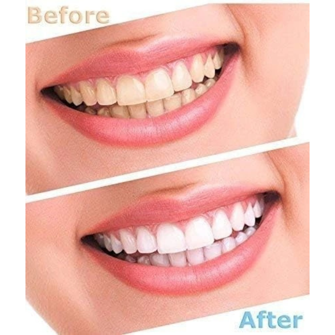 Electric Tooth Polisher Whitener & Stain Remover with LED Light Technology.