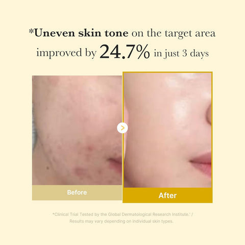 Medicube Kojic Acid Turmeric Night Wrapping Mask - An overnight facial Mask to brighten dull skin and Restore clarity