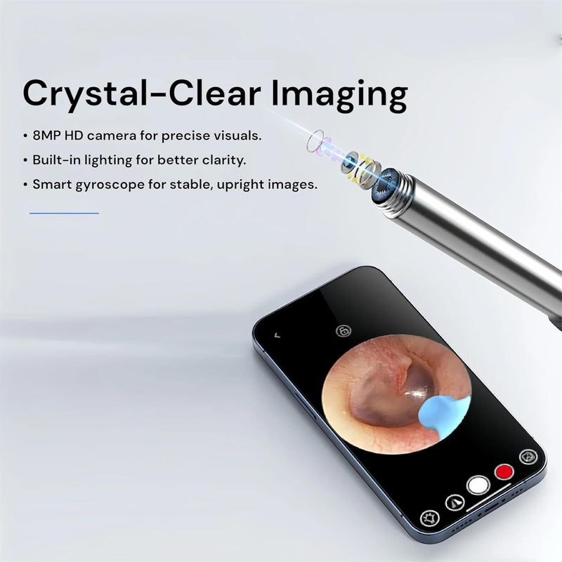 Professional Ear Wax Removal Kit – Wireless Camera & LED Light
